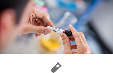 Label på prøve